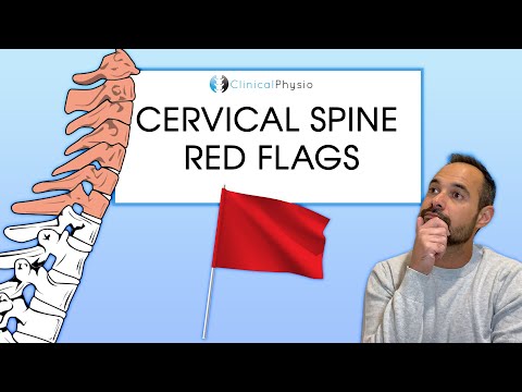 Cervical Spine Red Flags | Expert Physio Review