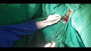 Curetagem uterina/ Uterine curettage