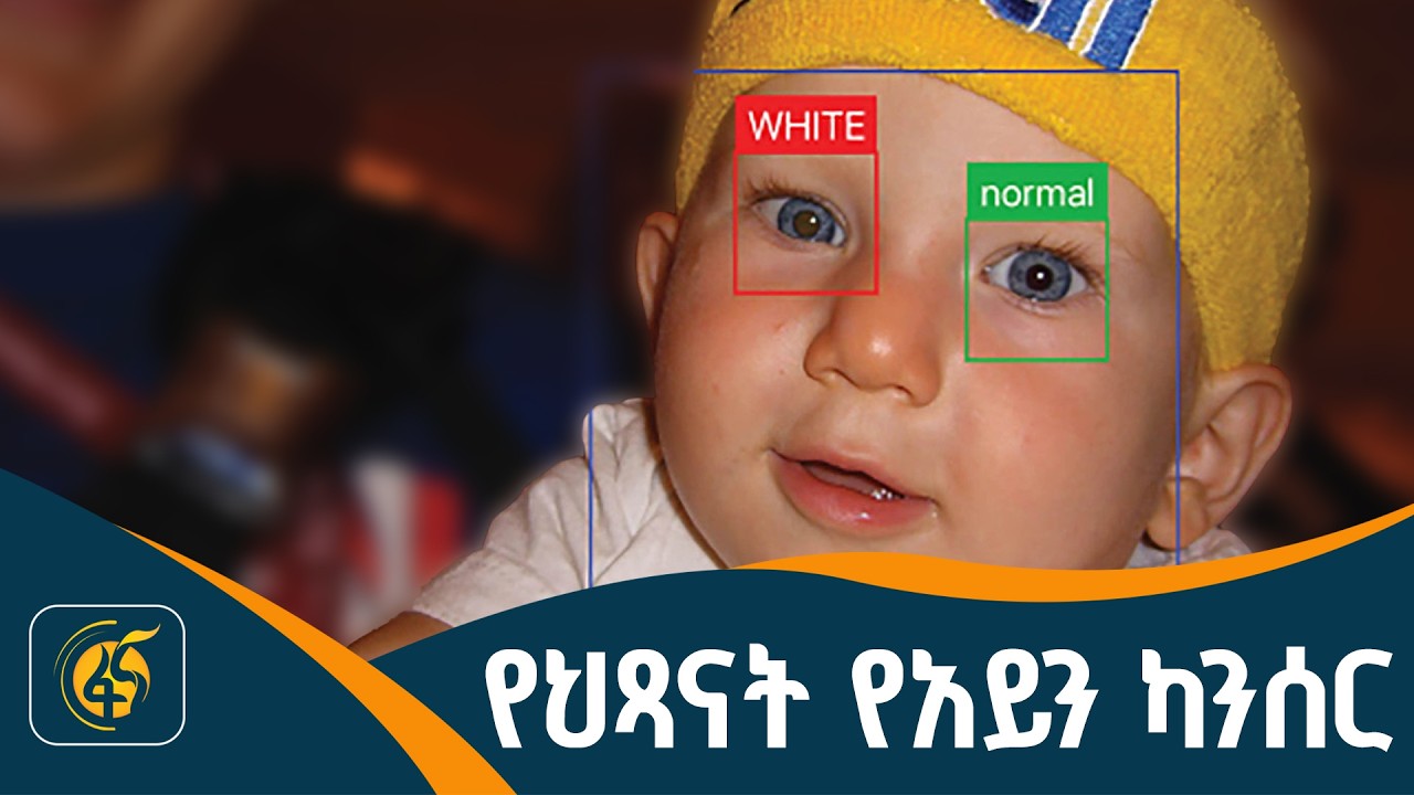 በምን ምክንያት ይከሰታል?