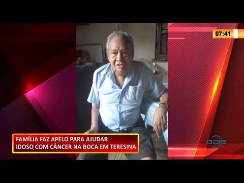 Família faz apelo para ajudar idoso com câncer na boca 17 11 2020