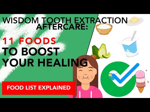 Wisdom Tooth Extraction Aftercare: 11 Foods to Boost Your Healing