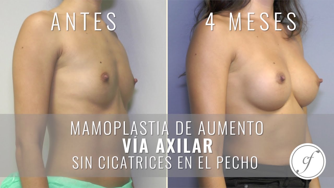 Eduardo Forcada Melero-41