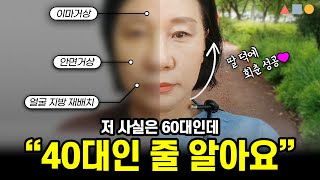 60대 안면거상 6개월차 후기 ❣ 딸 덕에 회춘 성공!_[삼사오 성형외과]