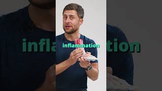 Avoid R.I.C.E for a sprained ankle