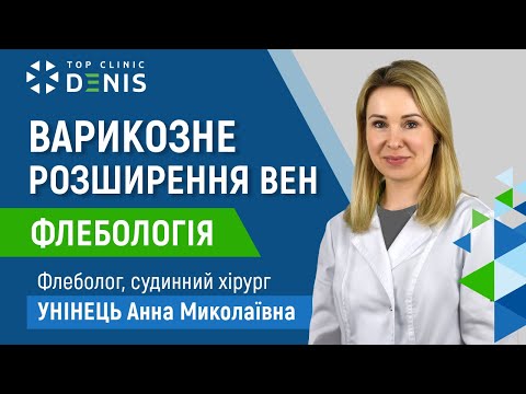 Варикозное расширение вен - TOP Clinic DENIS