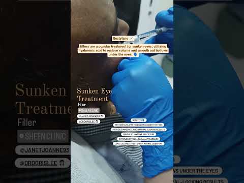 Restylane Skin Booster for Sunken Under Eyes