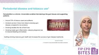 Episode 5 - Tobacco and oral health