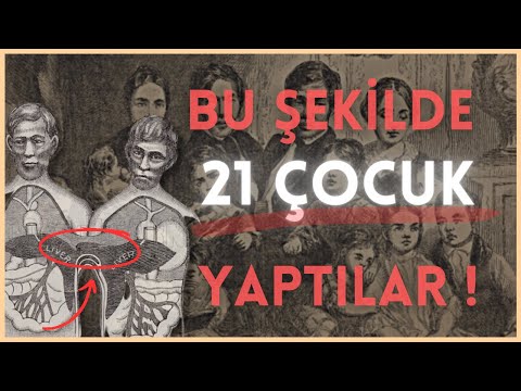 TUHAF BİR HAYAT HİKAYESİ - Tarihin En Ünlü Siyam İkizleri