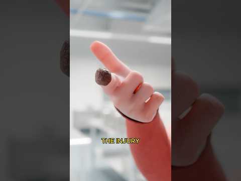 How Kids Can Regrow Fingers 😱 Surgeon Reacts
