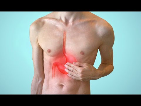 GERD, Gastroesophageal reflux disease - Heartburn - MADE EASY