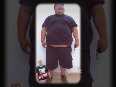 Logo of 15‑Month Gastric Bypass Check‑In: Incredible Transformations in Mexico