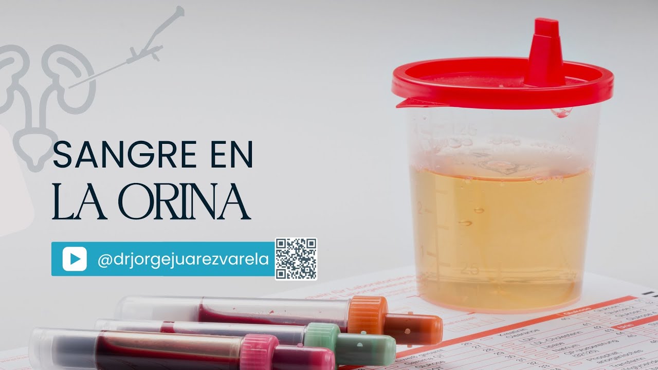 Jorge Alberto Juárez Varela-82