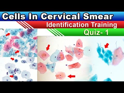 Cervical Smear Cells Identification Training Quiz  1/2