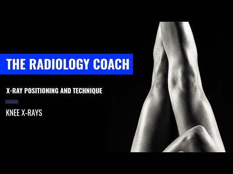 How to SHOOT X RAYS of the ANKLE