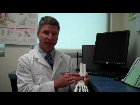 Total Ankle Replacement