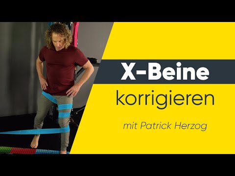 X-Beine korrigieren
