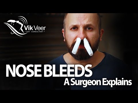 10 ways to Stop a Nose Bleed - A Surgeon Explains