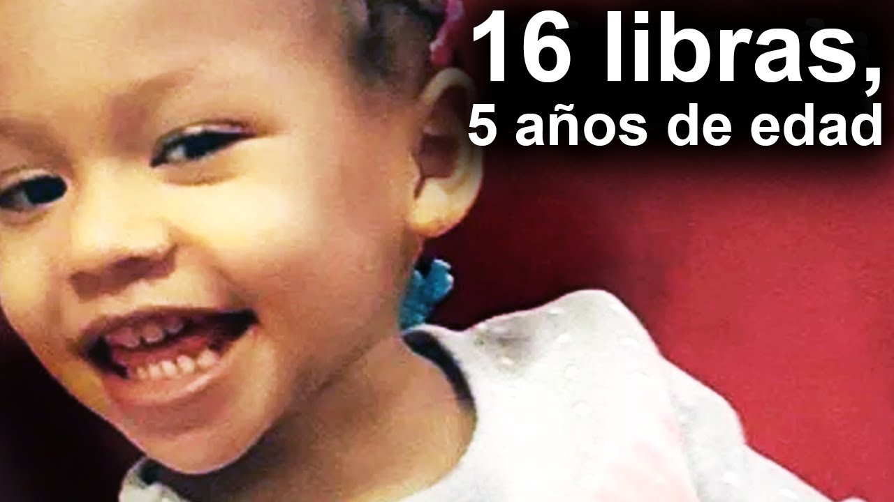 16 Libras a los 5 años: El Perturbador Caso de Cali Anderson