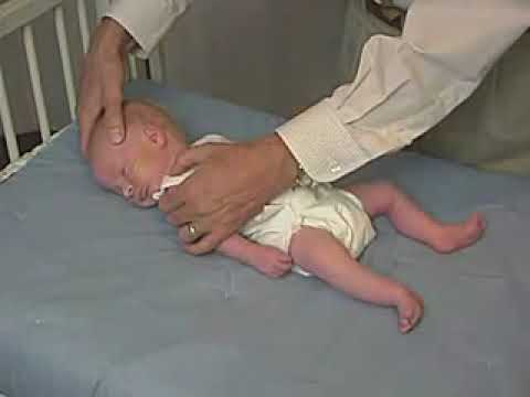 4.14 - Tone, Neck Tone - Newborn Abnormal - Infant Clinical Examination(MRCP)