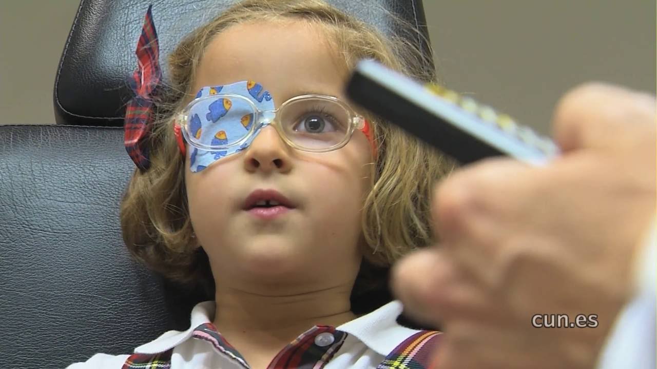 Cómo ayudar a corregir el ojo vago