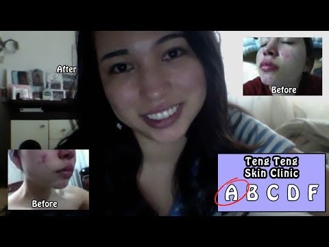 Review: TengTeng Skin Clinic = A+!
