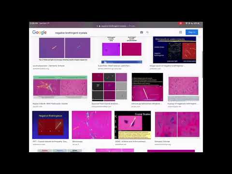 USMLE Crash Course - MASSIVELY IN-DEPTH RIPE Therapy Analysis (TB) Step 1 / Step 2 CK / USMLE
