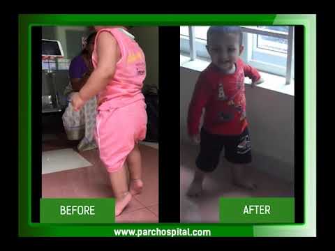 PARC recovery video