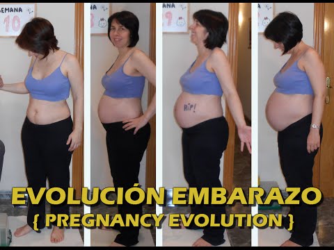 Leliminazione pigmentary nota su una faccia un photoepilation Il ballo collettivo di un konopushka