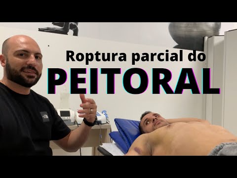 Pectoral injury, what to do now? #weighttraining #bodybuilding #pectoral