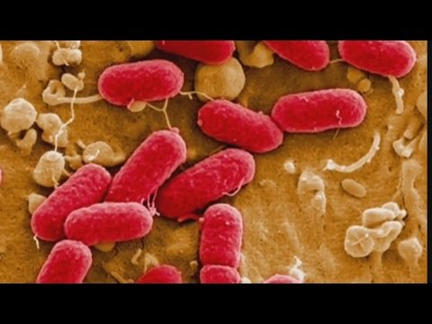 Good Question: How Does E. Coli Get Into Our Food?
