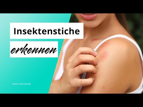 Insektenstiche: Was hat mich gestochen?