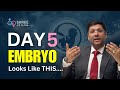 What Is a Good Embryo? IVF Grading Explained Step-by-Step! | Dr Jay Mehta, Mumbai