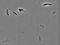 E Coli Cells Explode