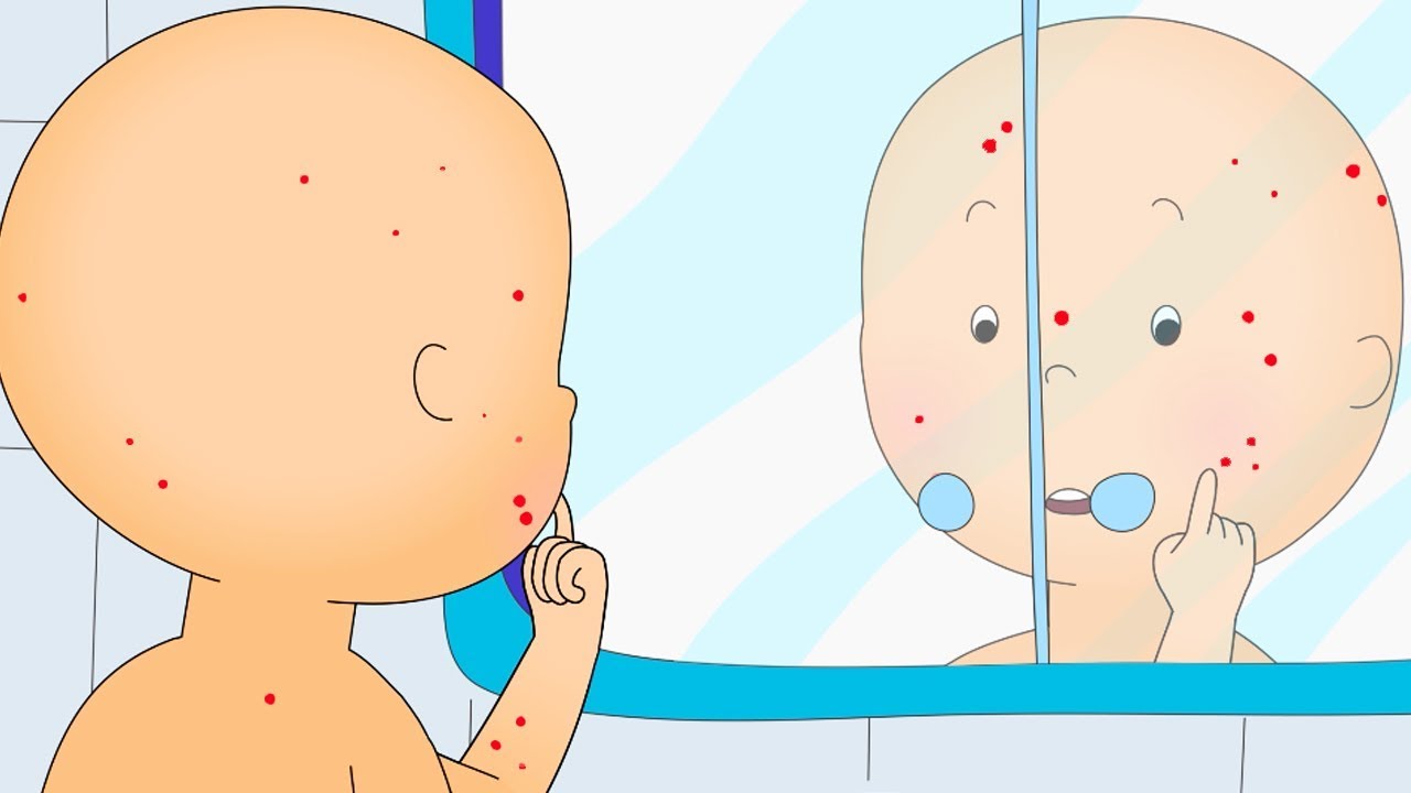 Caillou En Francais Caillou A La Varicelle Dessin Anime Dessin Anime Pour Bebe Nouveau 18 Caillou En Francais Wildbrain Pausefun Caillou En Francais Caillou A La Varicelle Dessin Anime Dessin Anime Pour Bebe Nouveau 18 Caillou En Francais Wildbrain Pausefun