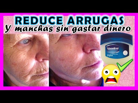 , title : 'VASELINA para QUITAR ARRUGAS  😱 🔴 Quita MANCHAS en 20 minutos ✅ - YOLIANA GAMBOA'