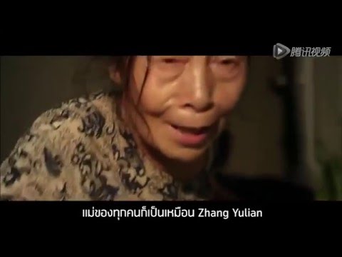 อาหารสำหรับโรคสะเก็ดเงิน palmoplantar โรคสะเก็ดเงิน นี้โรคสะเก็ดเงินทั่วไป
