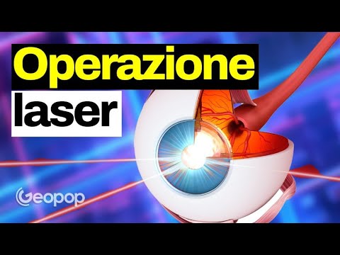 Intervento laser agli occhi, come funziona: le tre tecniche per correggere i difetti della vista