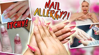 Nail Allergy Remedy (That Will Definitely Save Your Life)