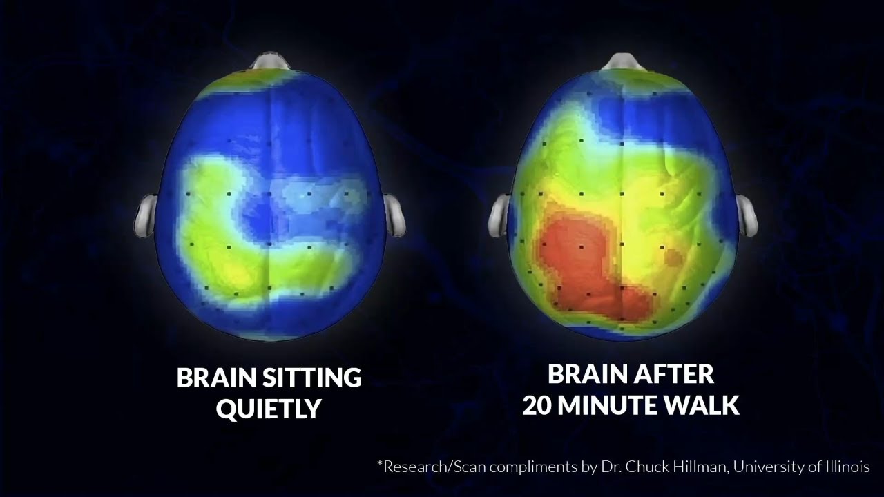 How lifelong movement supports your brain | Christopher Wilson | TEDxNewAlbany