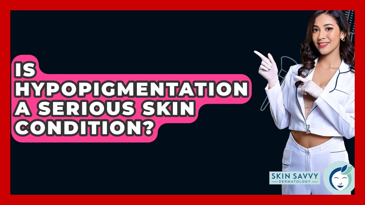 Is Hypopigmentation A Serious Skin Condition? - Skin Savvy Dermatology