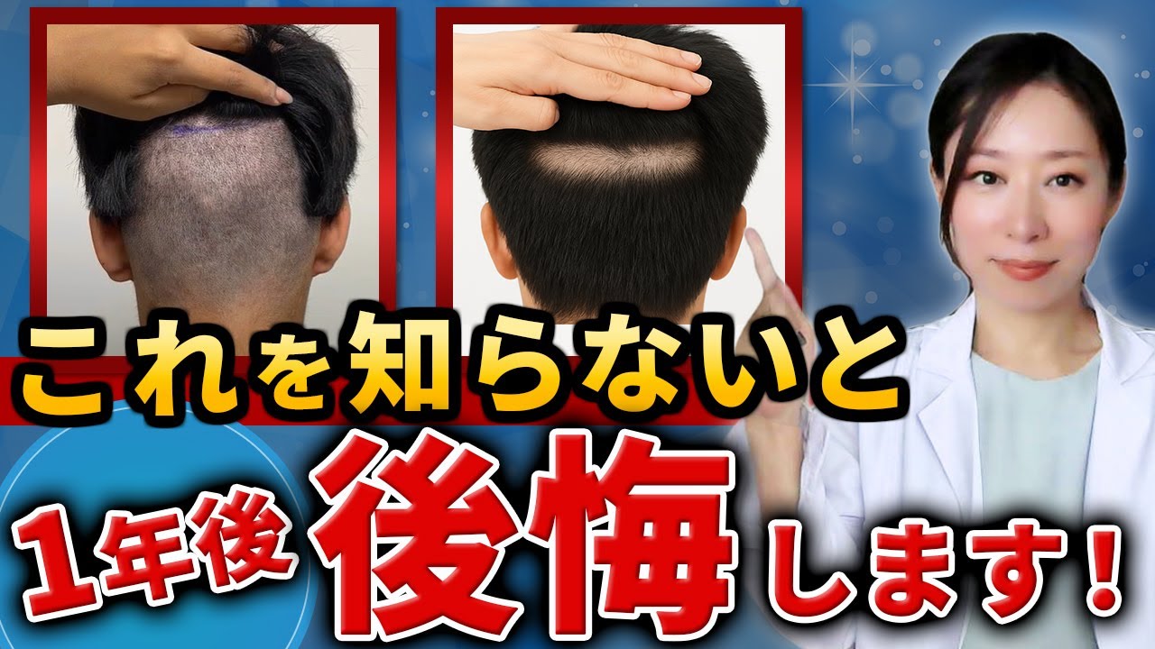 【超重要】植毛の成功は「毛の取り方」で決まる！後頭部ドナー採取の違いとは？