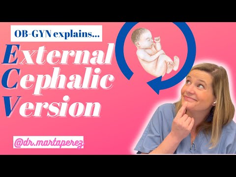 ECV! Flip the baby! OBGYN explains External Cephalic Version to turn babies from breech to cephalic