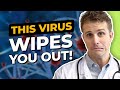 Epstein Barr Virus -#1 Culprit for Chronic Fatigue and a Myriad of Health Issues