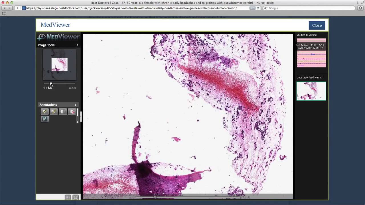 Traditional Treating Physician Portal Training Video