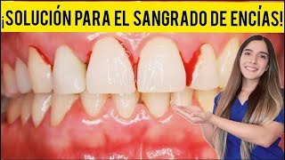 ¡SOLUCIÓN PARA EL SANGRADO DE ENCÍAS! | ¿POR QUÉ SANGRAN LAS ENCÍAS Y ALGUNAS RECOMENDACIONES