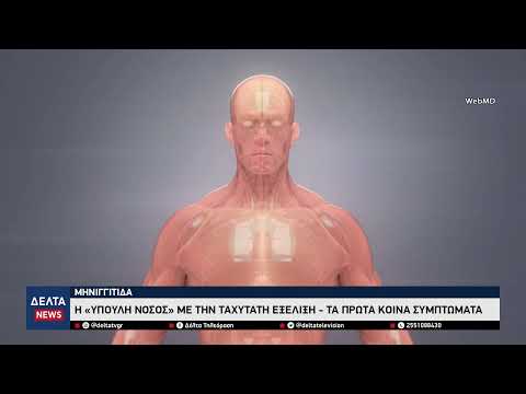 Μηνιγγίτιδα : Η «ύπουλη νόσος» που μοιάζει με ίωση αλλά απειλεί ζωές – Τα πρώτα κοινά συμπτώματα