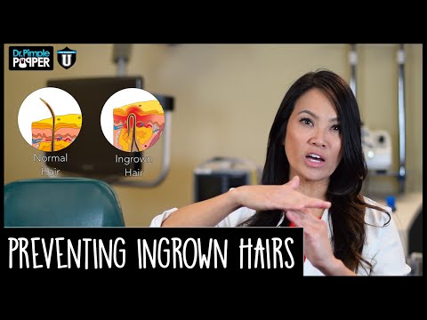Preventing Ingrown Hairs - POP QUIZ!