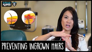 Preventing Ingrown Hairs - POP QUIZ!