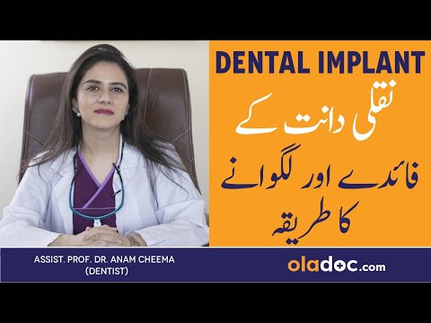 What Are Dental Implants - Nakli Dant Lagwana Kyun Zaruri Hai - Dental Implants Procedure & Life