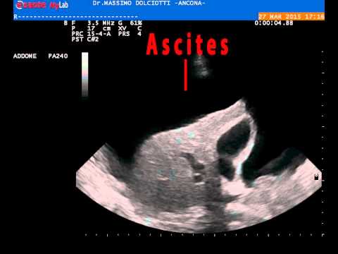Capsula di medicina di alcolismo Bevo la settimana come lanciare